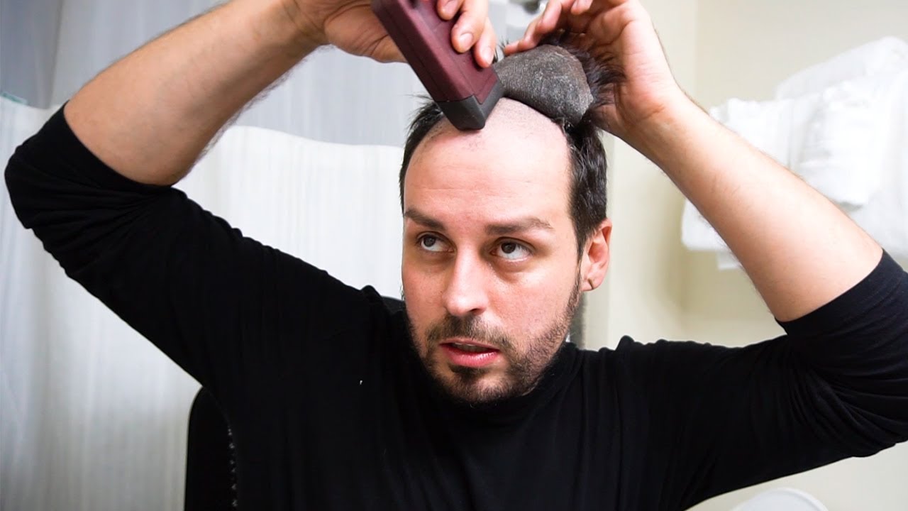 HAIRMERGENCY  How to re adhere a hair piece