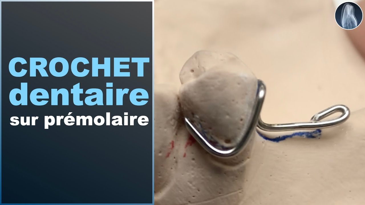 Apprenez &agrave; Fa&ccedil;onner un Crochet Parfait avec la Pince Waldsachs &ndash; Tutoriel Pas &agrave; Pas !