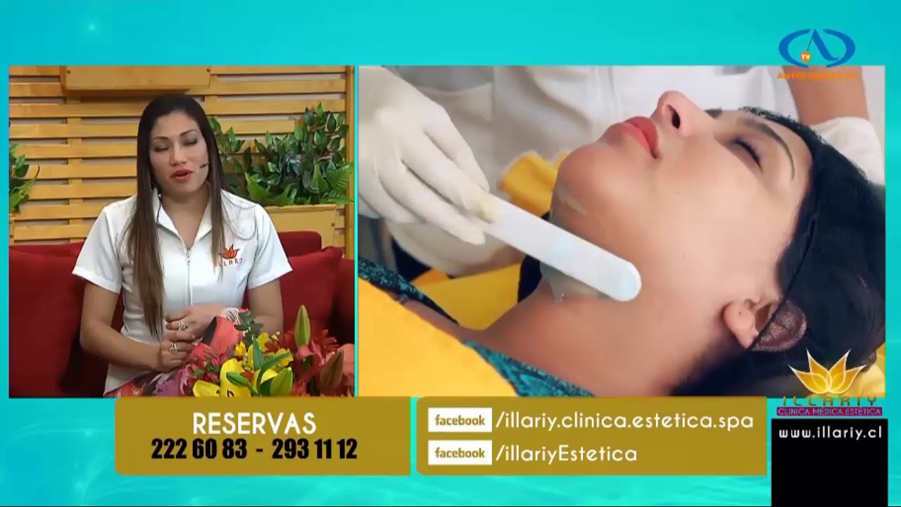 Hifu 3D la mejor opción para la papada