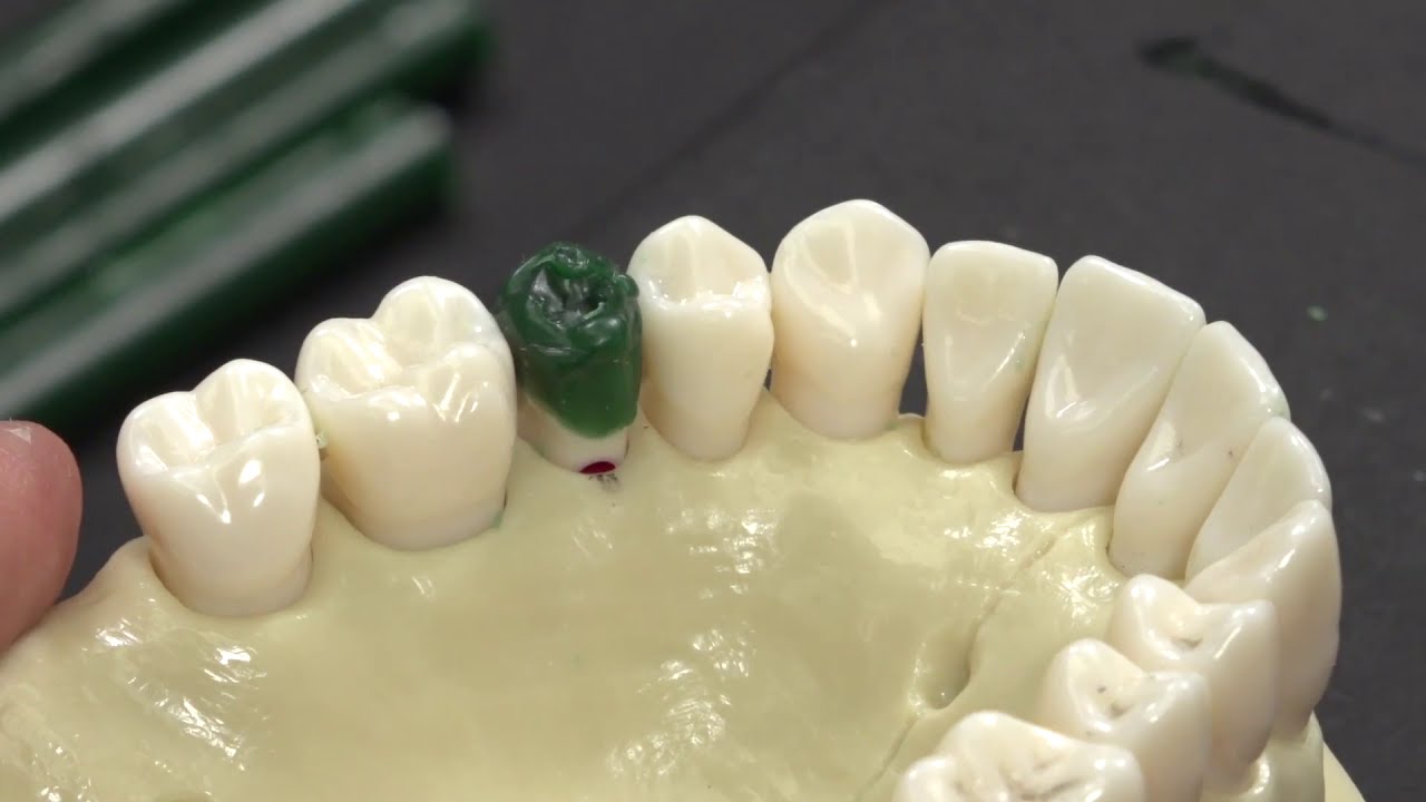 Waxing Tooth #4 Pre Molar Waxing | Dental School | Pre-Dental | INBDE | Dental Anatomy | Wax