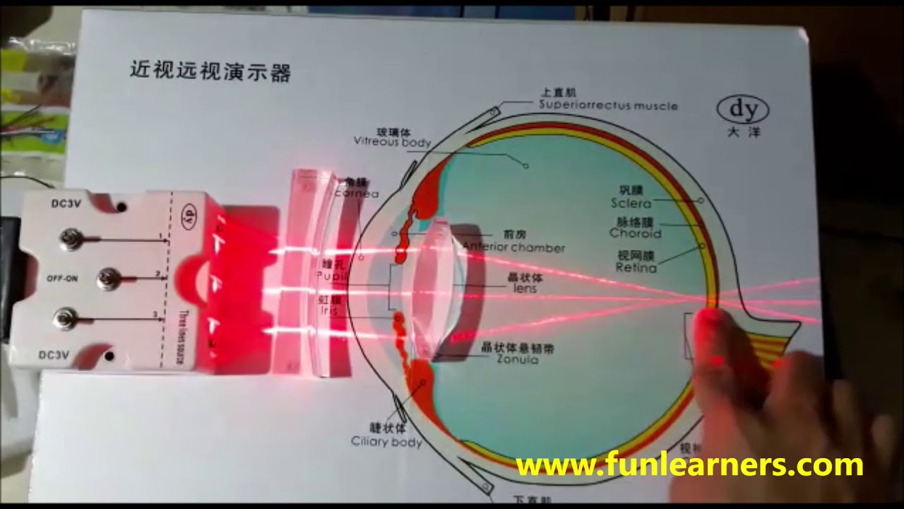 long sightedness and short sightedness demo
