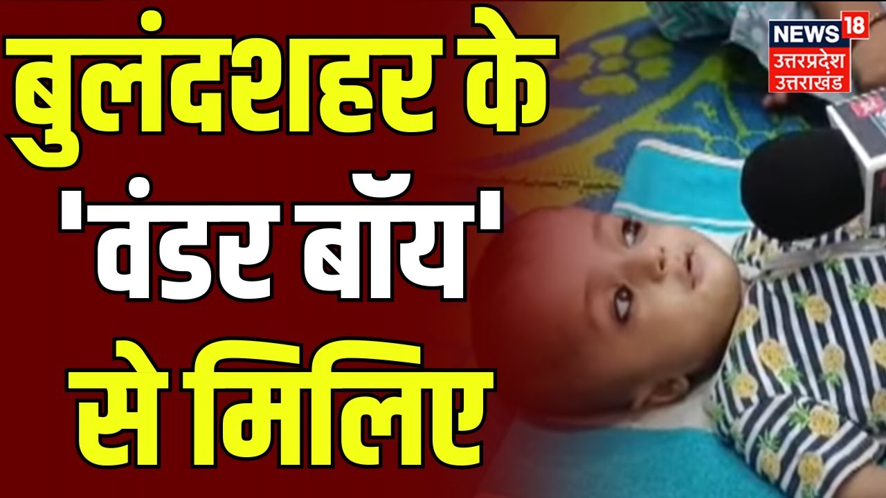 Bulandshahr News: तेज दिमाग वाला मासूम डुग्गू गंभीर बीमारी से जूझ रहा | Tez Dimaag Duggu | Top News