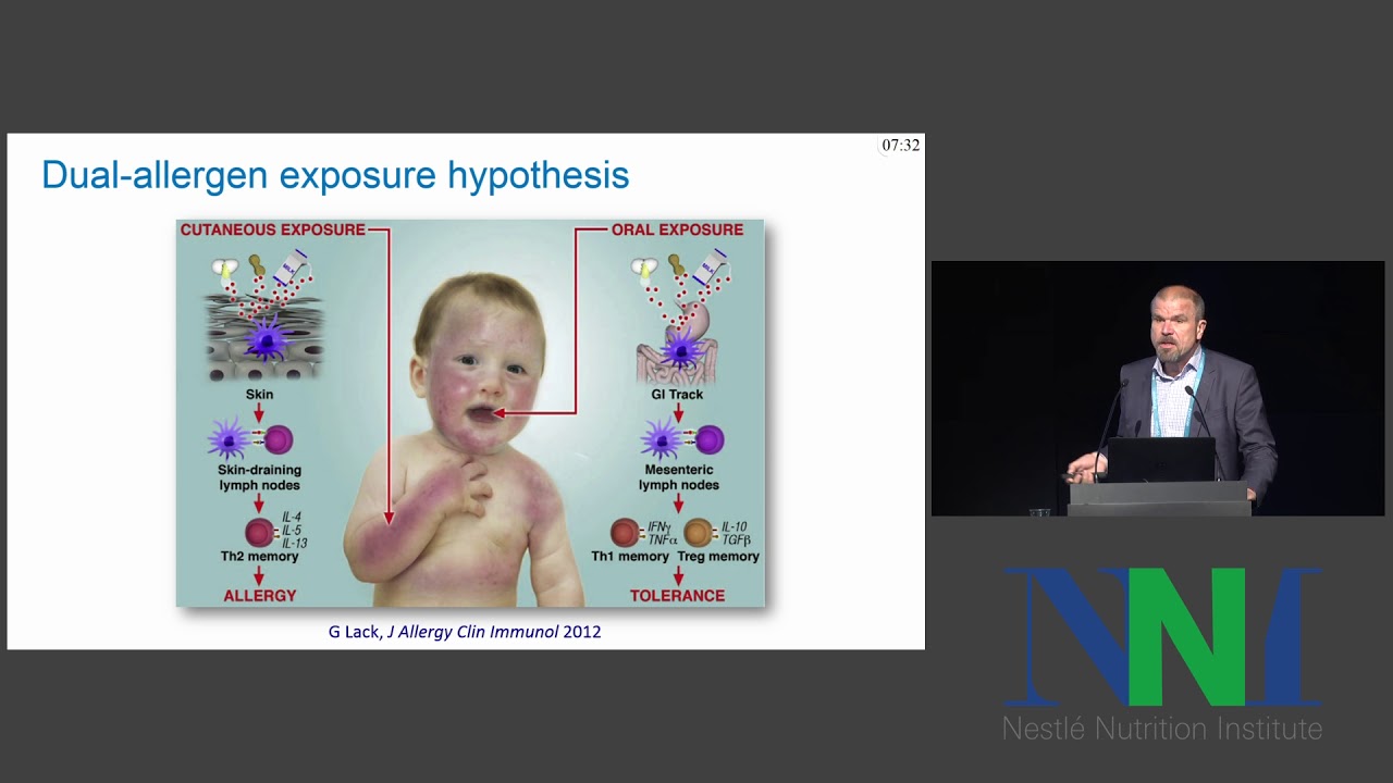 Atopic Dermatitis and Food Allergy Change of Concepts - Ralf Heine