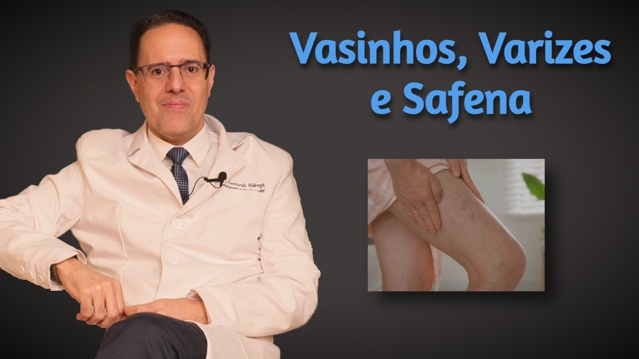 Vasinhos, Varizes e Veias Safenas: Entenda as Diferenças e Quando Tratar com Segurança