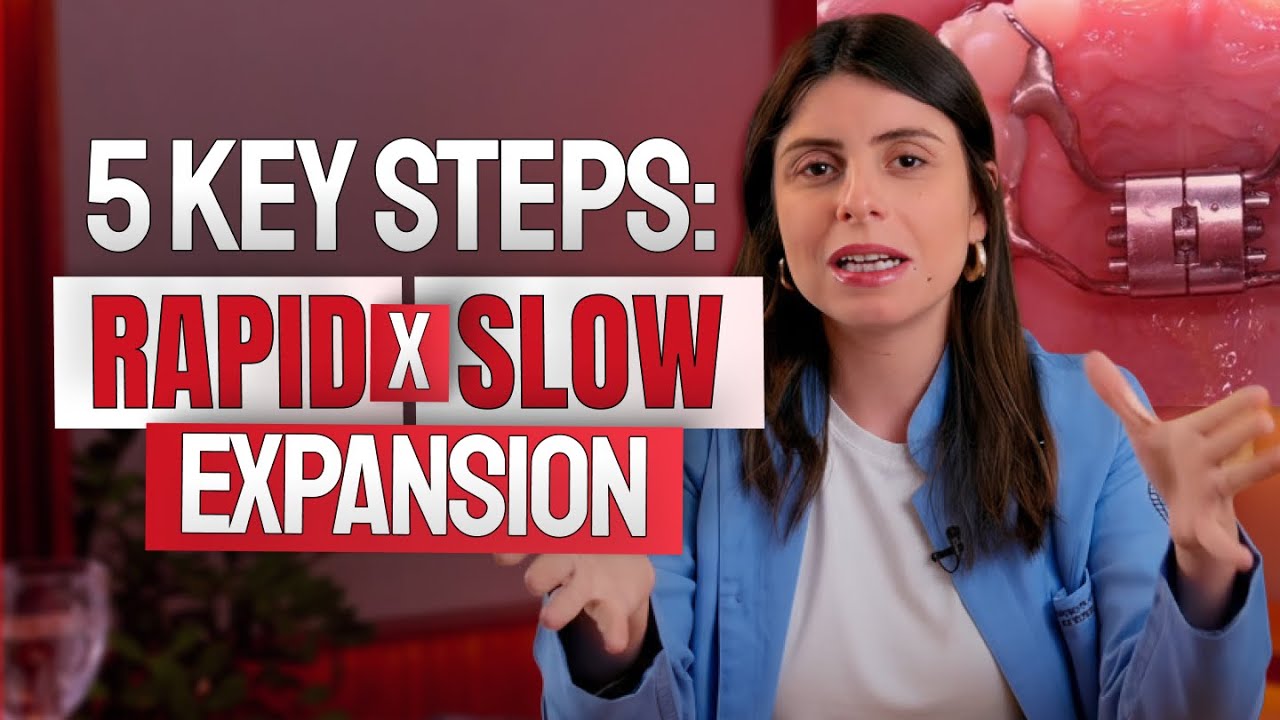 The 5 steps to choose between Rapid or Slow Expansion
