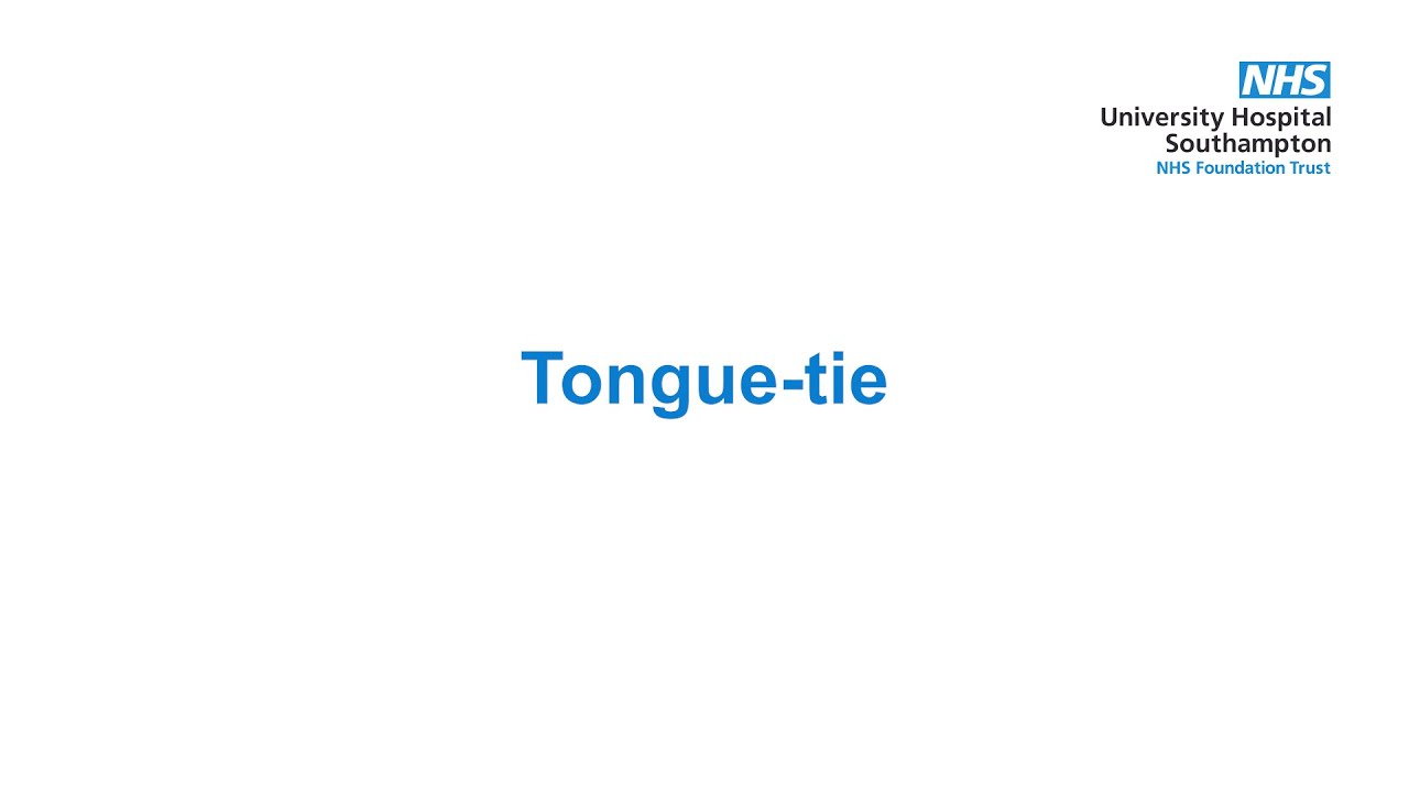 10. Tongue Tie