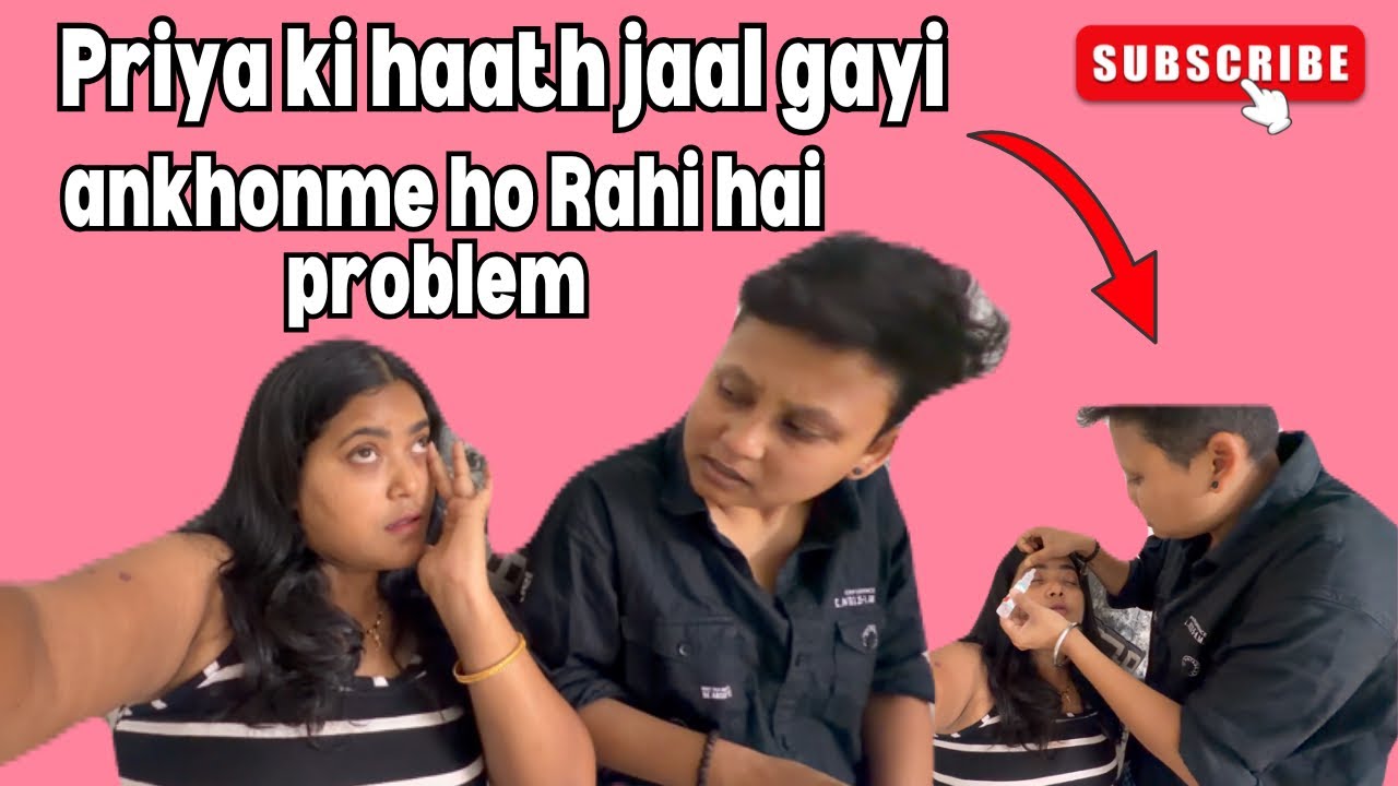 Priya ki haath jaal gayi🥺🥺ankhome ho rahi he  problem🥹🥹ll lgbtqll #dailyvlog #love #couple #romance 