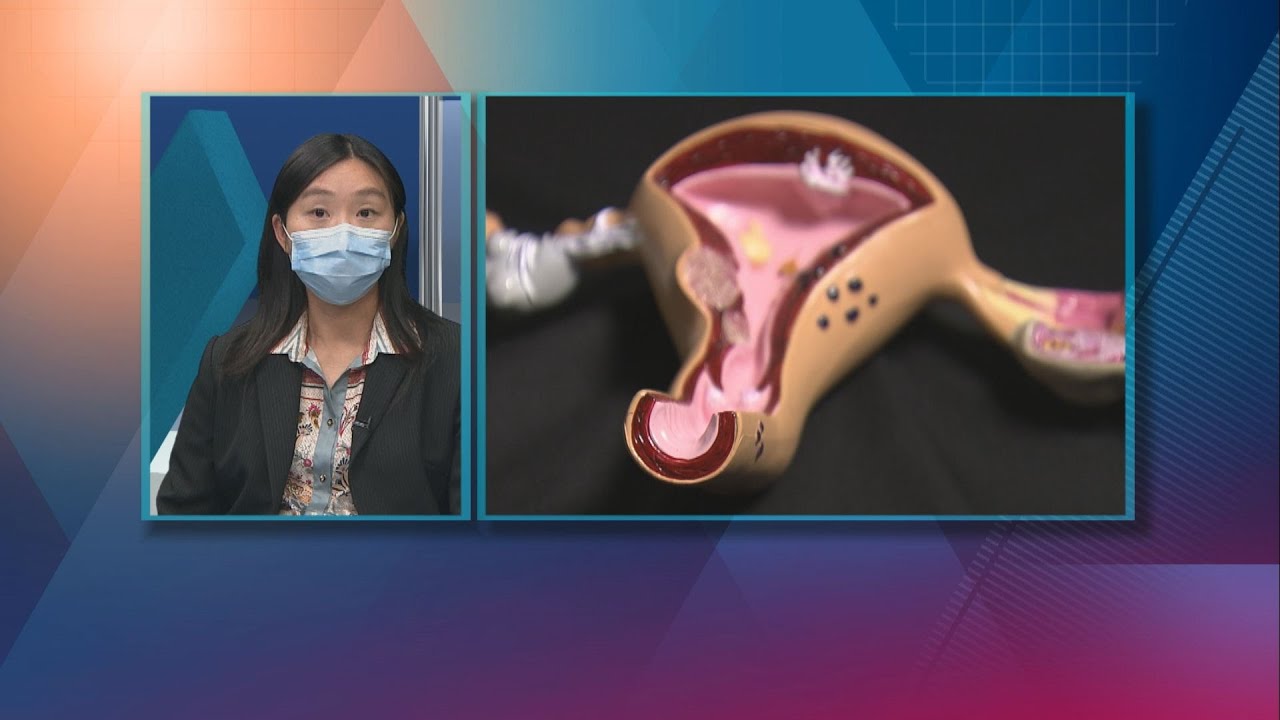 20210412【杏林在線】注意停經後出血
