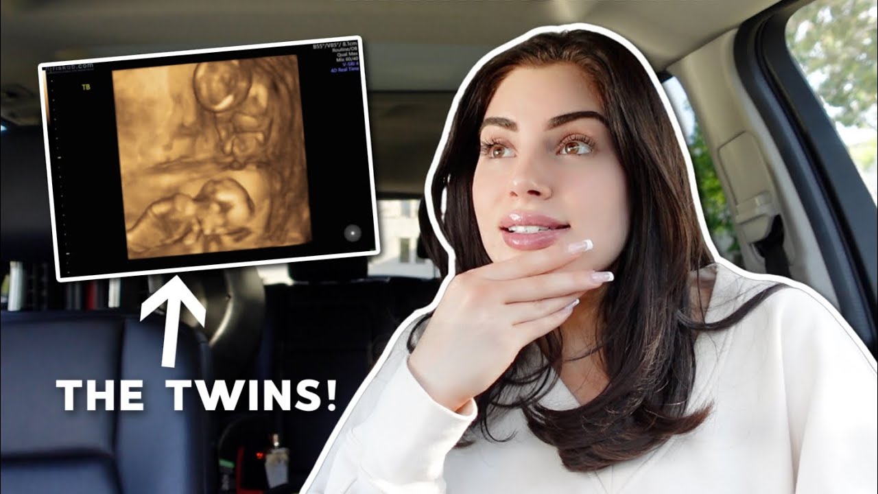 Getting Our First 3D Ultrasound of the Twins!!