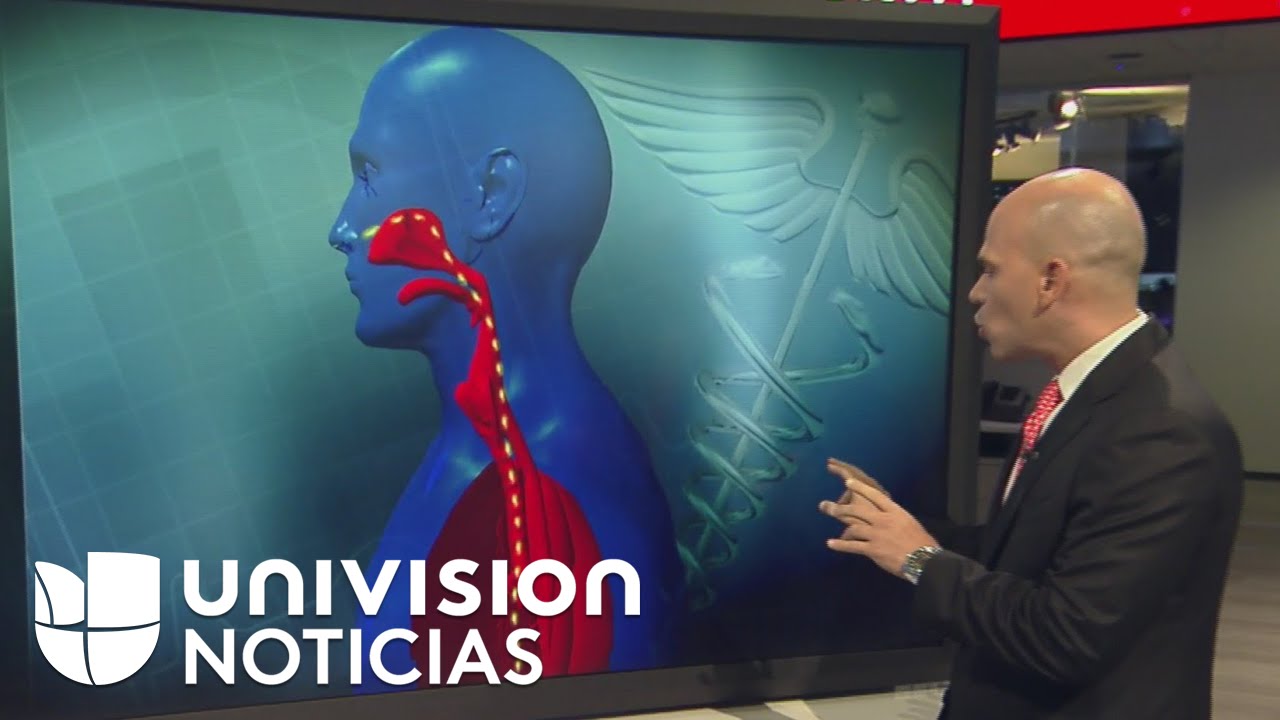 &iquest;Qu&eacute; tan complicada puede ser una neumon&iacute;a?