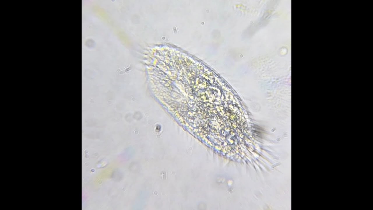 freshwater life compilation — surface water