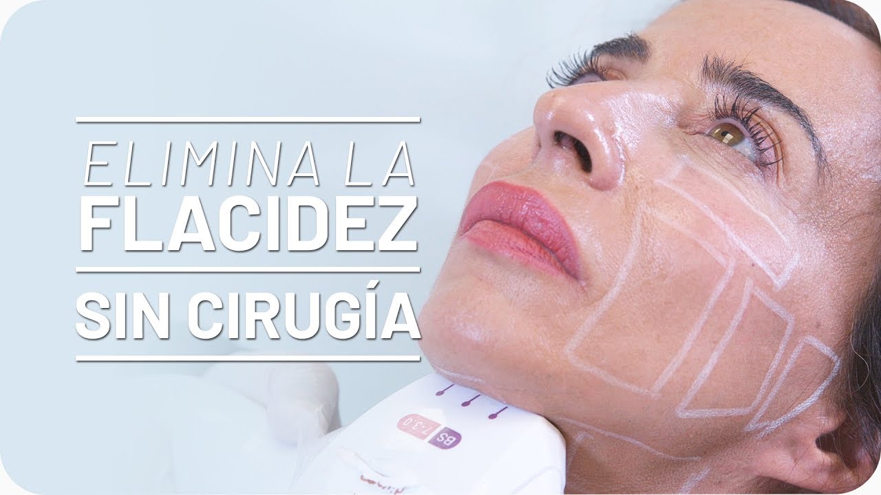 HIFU para Eliminar Papada: María Patiño prueba los Ultrasonidos [Testimonio]