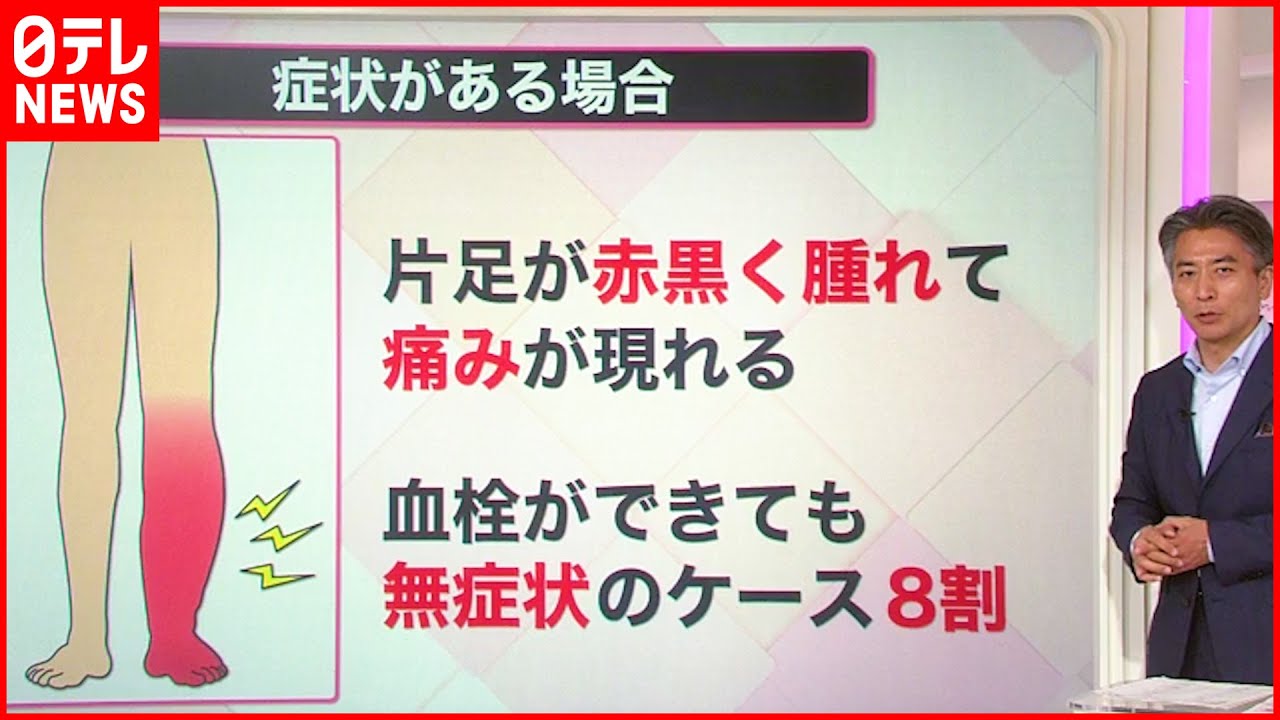 【解説】上皇后さま“血栓症”と診断 無症状「8割」若い人にもリスク？『知りたいッ！』