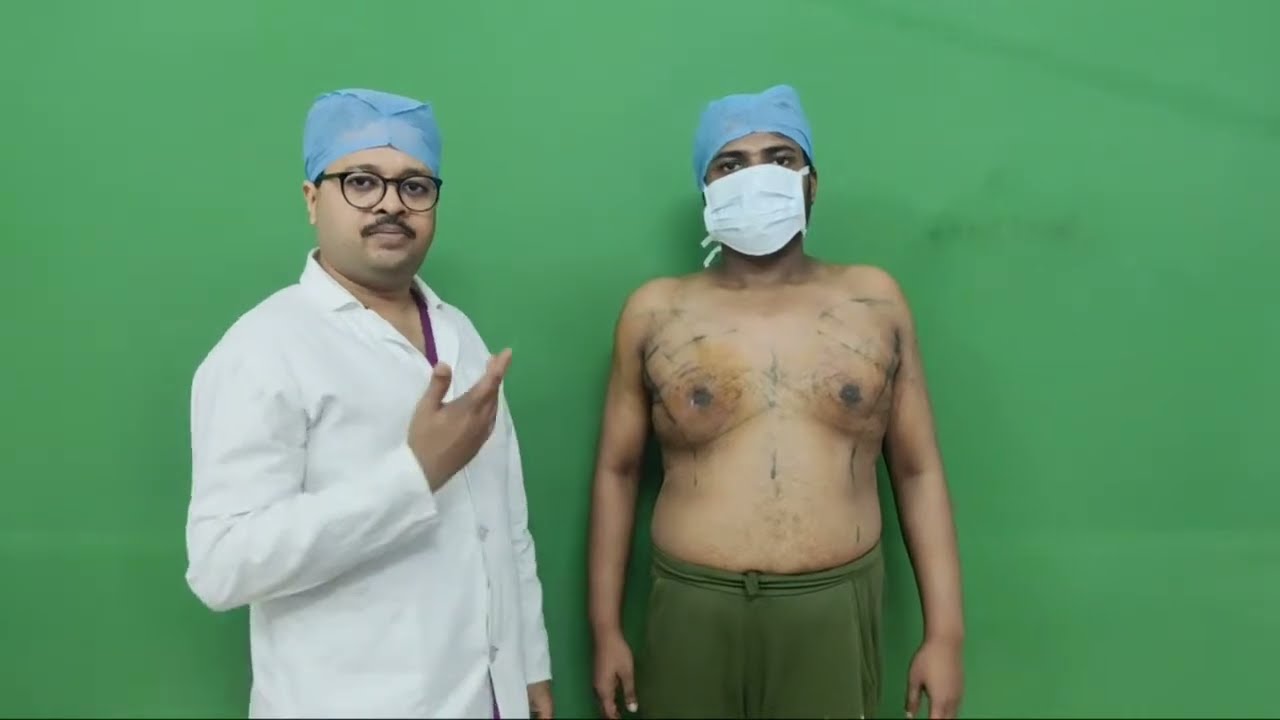 Gynecomastia বাংলাদেশ: Result