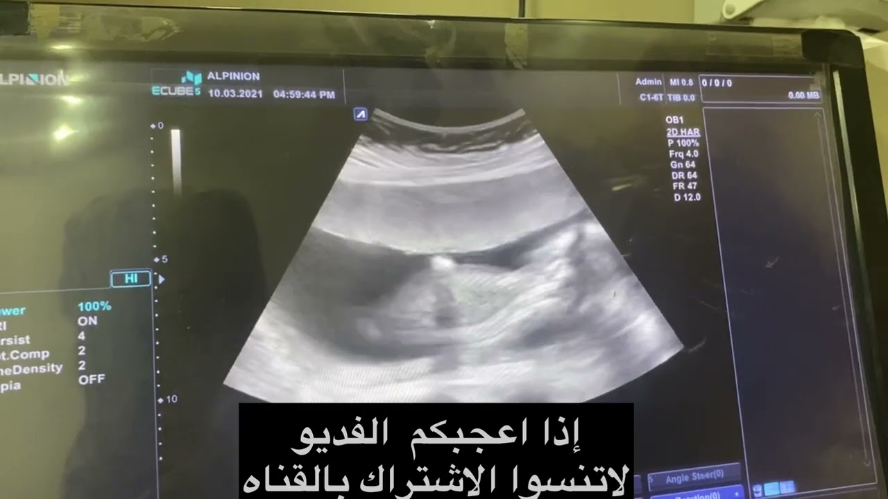 ٧ سبتمبر، ٢٠٢٤