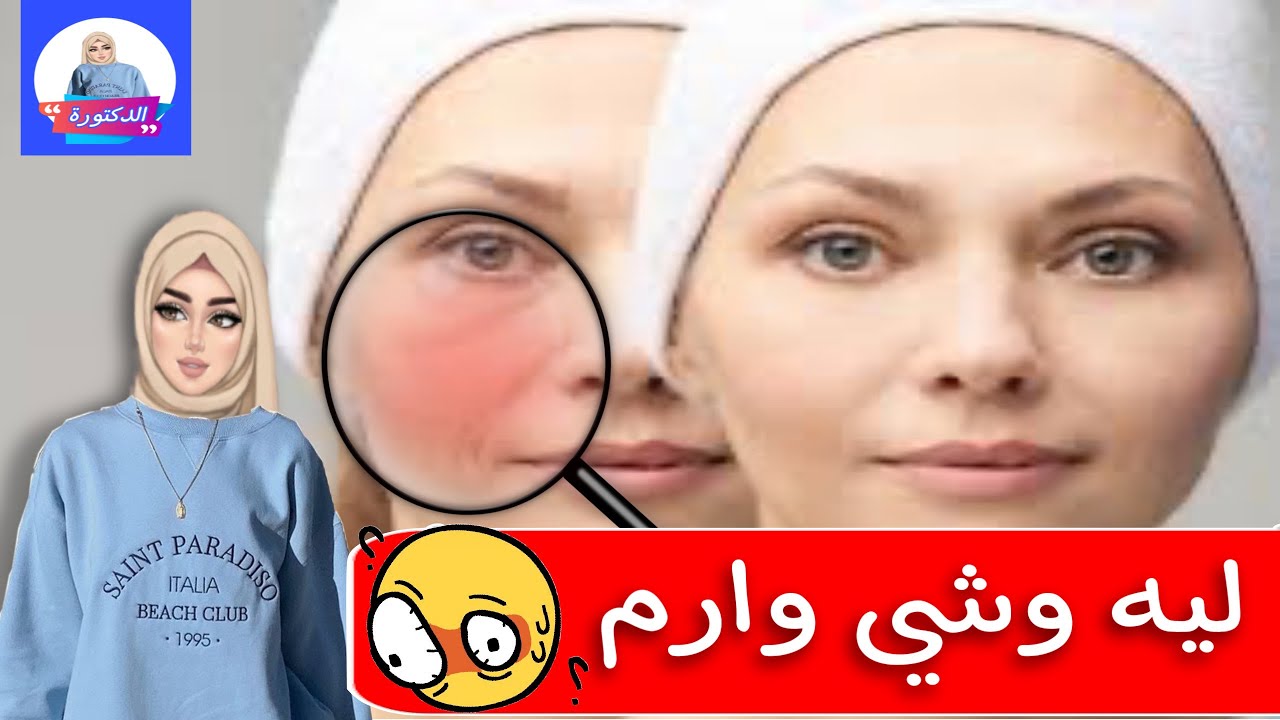 تورم وتنفخ الوجه و تحت العين بعد خلع الضرس الأسباب و العلاج