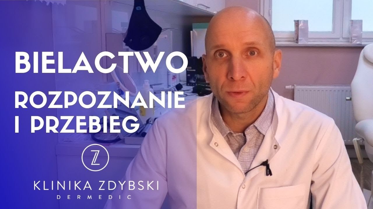 Dermatolog mówi o: Bielactwo - rozpoznanie i przebieg