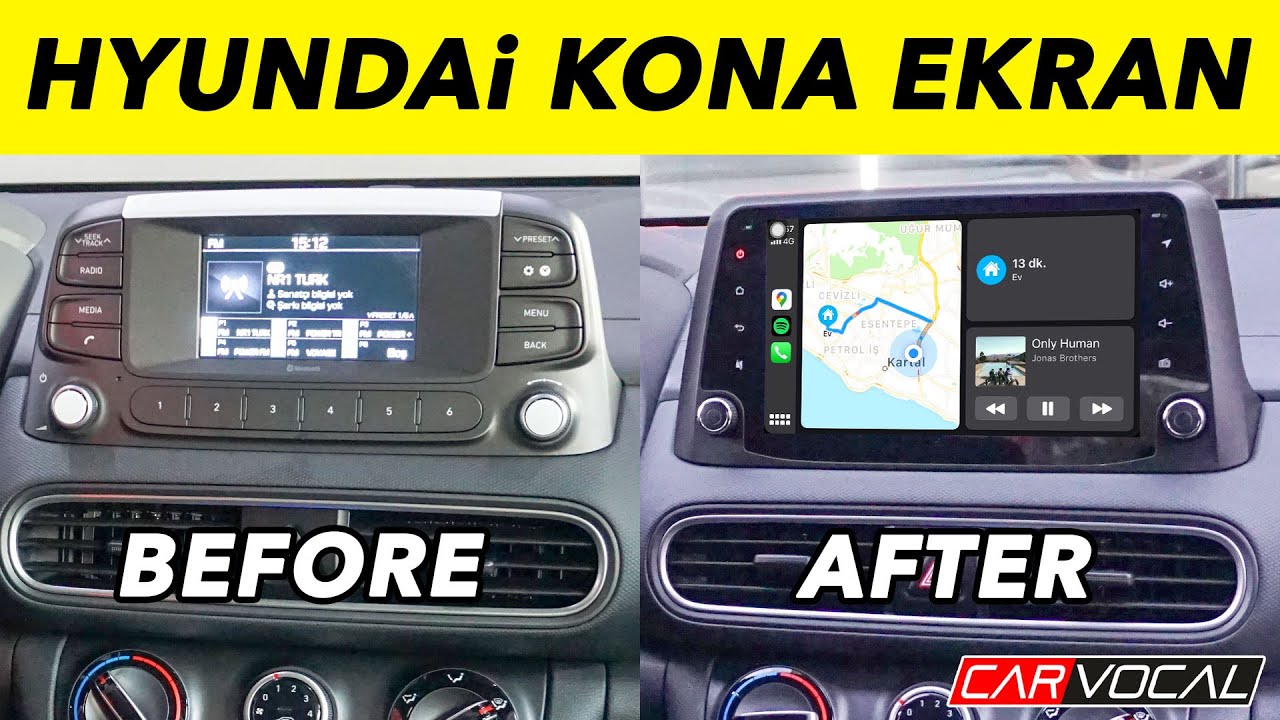 Hyundai Kona Android Multimedya Sistemi