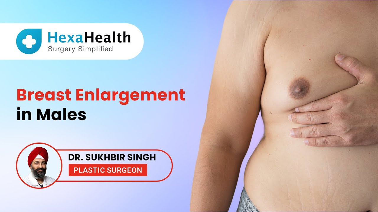 Why does Gynaecomastia occur? ||HexaHealth Expert