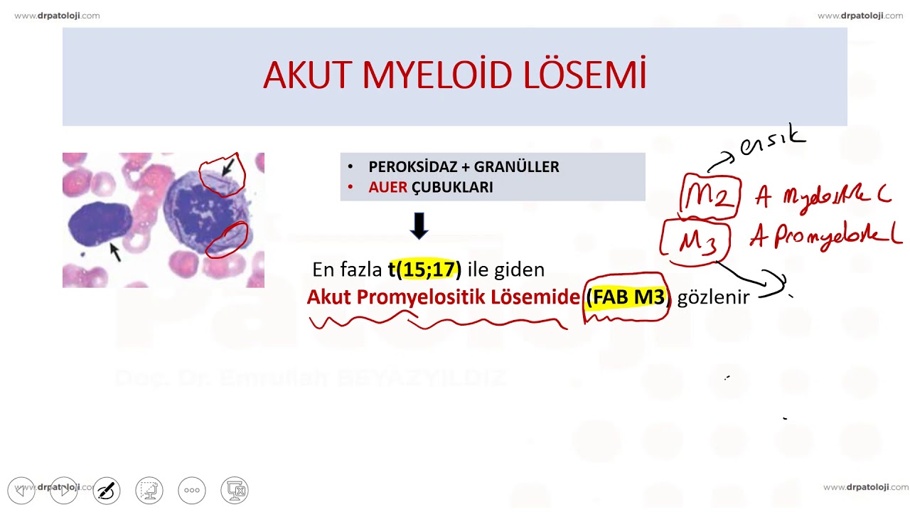 Kronik Myeloproliferatif Hastalıklar, Timus ve Dalak Hastalıkları
