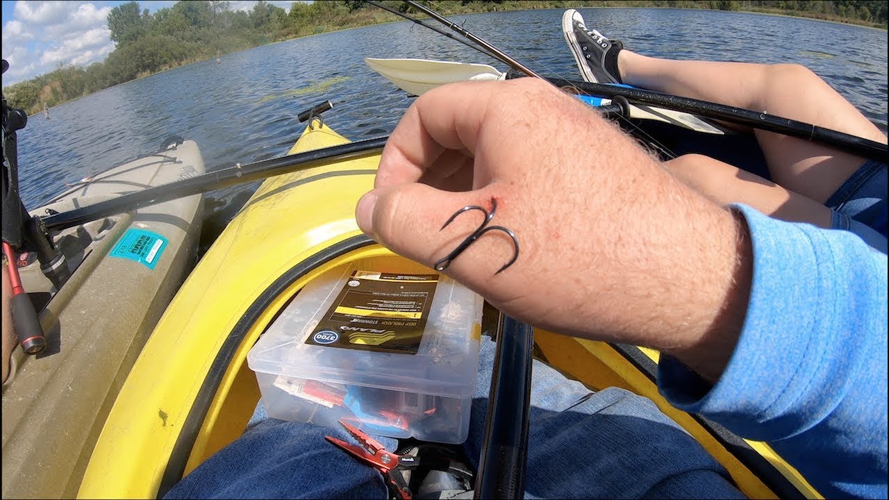 How to PAINLESSLY Remove a Fishing Hook from HAND!!!