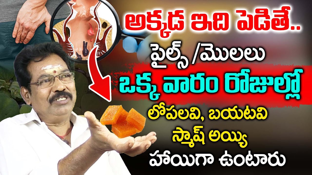 అక్కడ ఇది పెడితే పైల్స్ మొలలు స్మాష్.. | Get Relief From Piles | Setti Satyanarayana | iDream Health