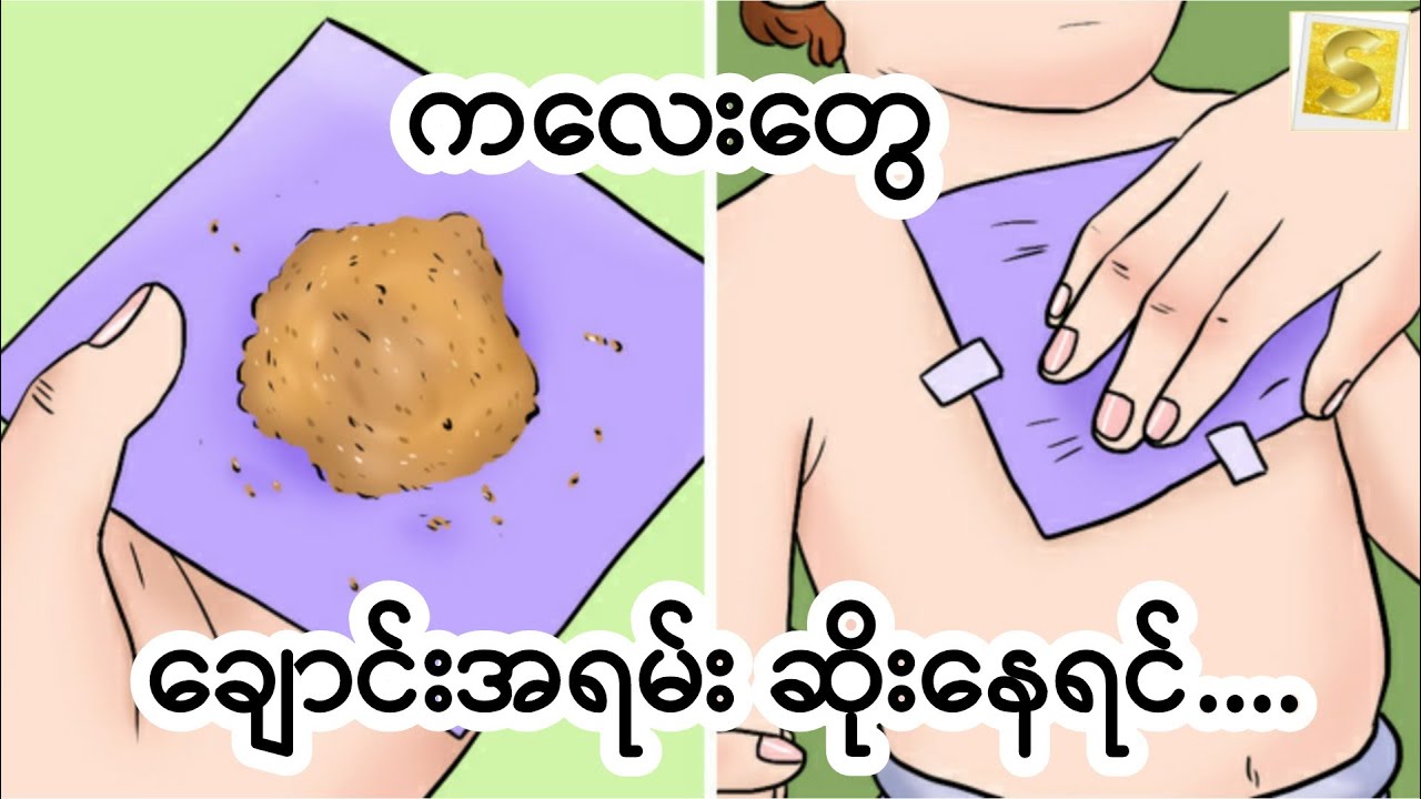 ကလေးငယ်တွေ ချောင်းအရမ်းဆိုးနေတာကို ချက်ချင်းသက်သာစေမယ့် အိမ်တွင်းနည်းလမ်းများ