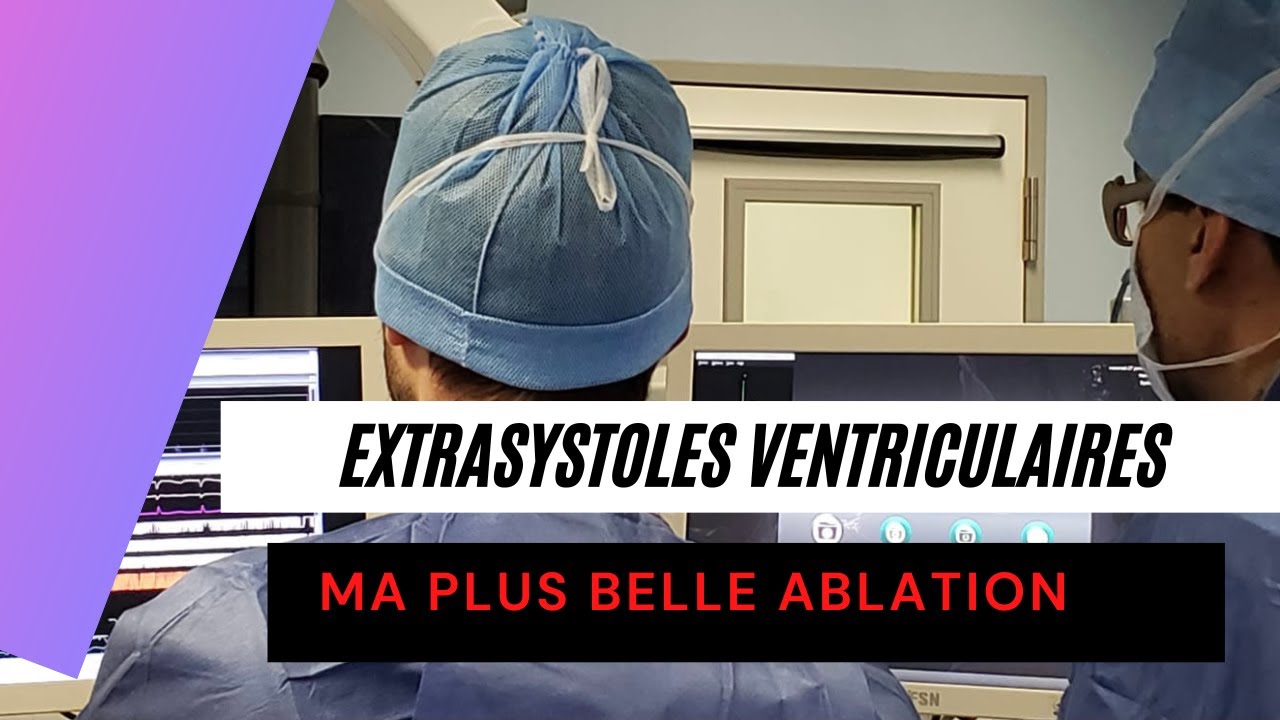 ♥️Ma plus belle #ablation d’ #extrasystoles #ventriculaires 🌟