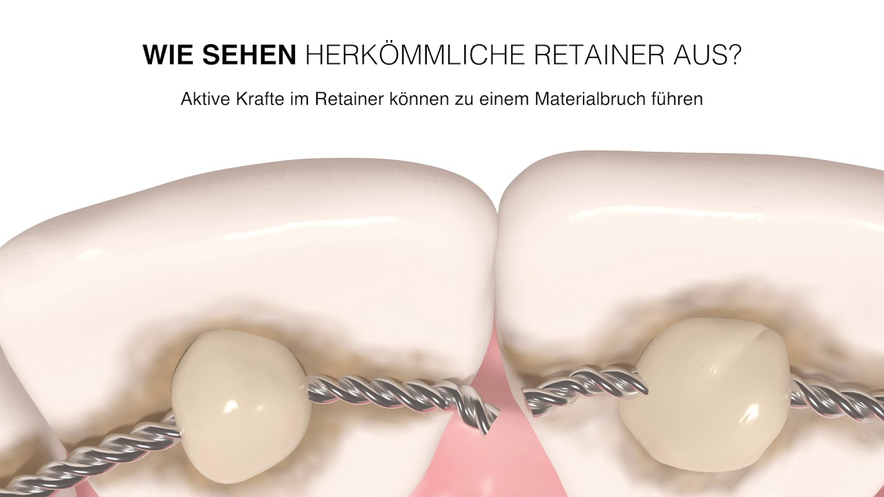 Memotain - Der digital Retainer von CA DIGITAL