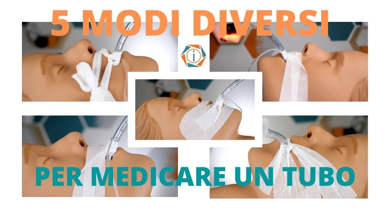 5 MODI DIVERSI PER MEDICARE UN TUBO ENDOTRACHEALE | INFERMIERI online