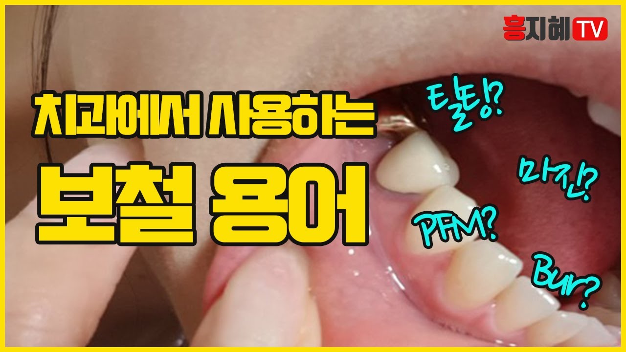 [난생처음,치과공부] #7.치과용어/임상에서 쓰는 보철용어(with Clova Dubbing)