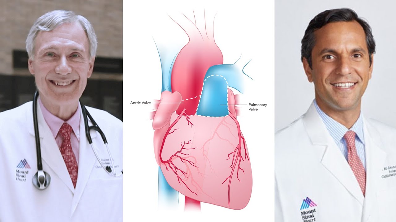 Ross Procedure Advantages for Aortic Valve Replacement with Dr. Paul Stelzer & Dr. Ismail El-Hamamsy
