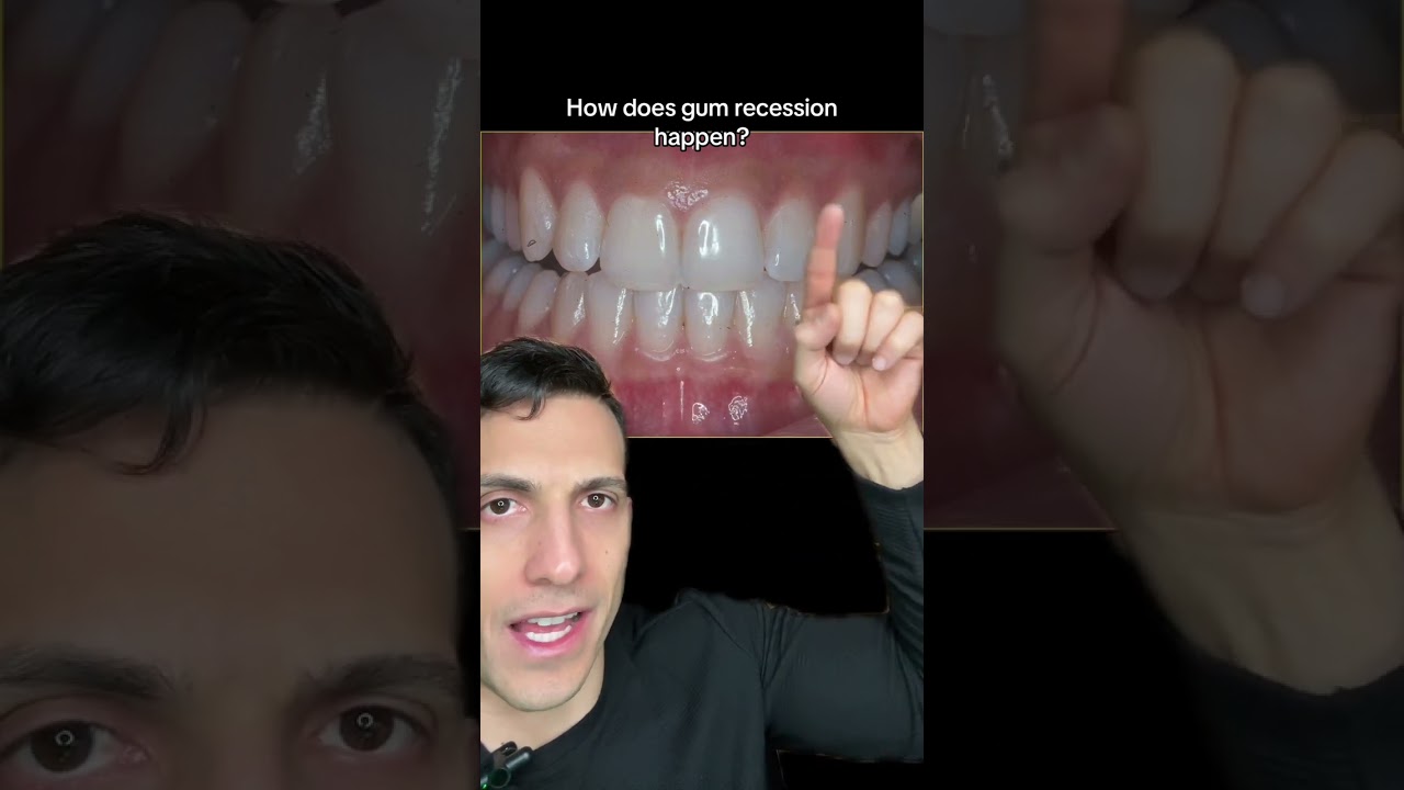 You can prevent gum recession with Invisalign!