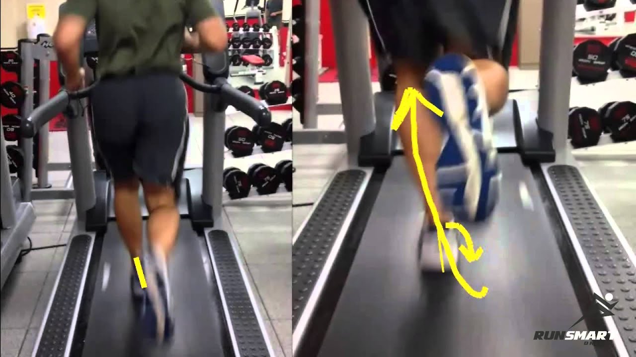 Underpronation and High Arches | RunSmartOnline.com