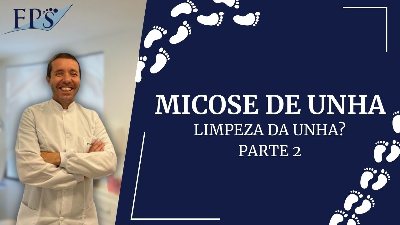 Micose de Unha - Limpeza da Unha - PARTE 2 #cursoonline #podologia #unhas