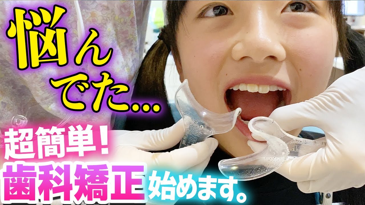 【歯科矯正】実はずっと悩んでた...前歯2本マウスピース矯正始めました。【インビザライン】