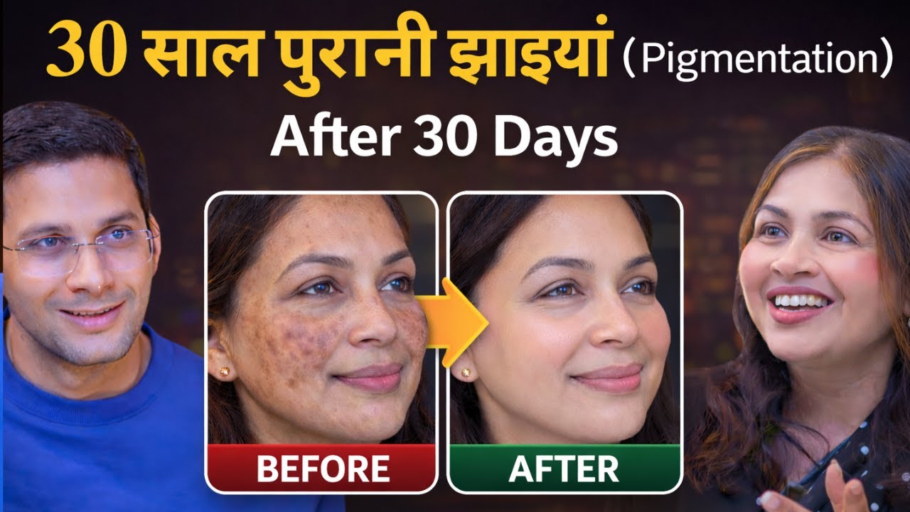 Jhaiya Khatam Karne Ka Tarika Ft. Dr. Neha Gera Homeopathy | Pigmentation | Himanshu Bhatt